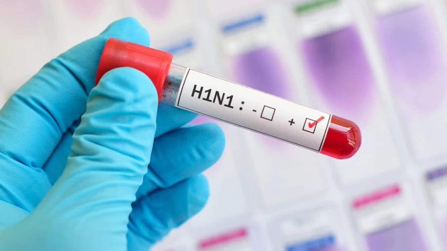 Surto de H1N1: Duas mortes em dois dias